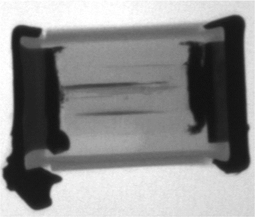 X-ray-image-showing-internal-bridging-of-film-capacitor