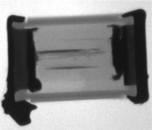 Figure 21. X-ray image showing internal bridging of a film-CAP.